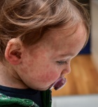 אמצעי מניעה - תמונת המחשה